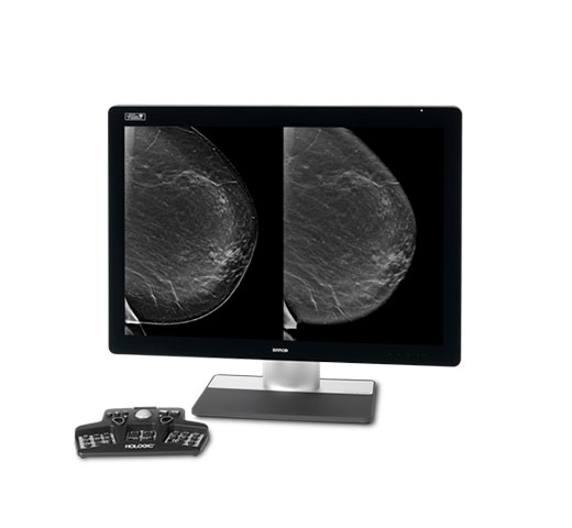 Immagini Sintetiche Intelligent 2D™ Hologic su sfondo bianco