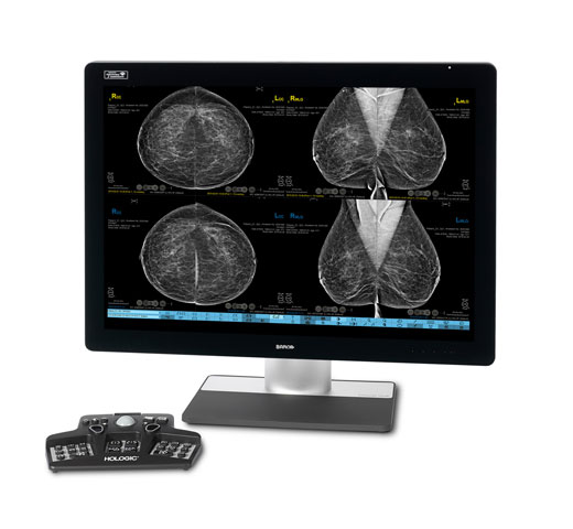 Workstation di refertazione SecurView® Hologic su sfondo bianco