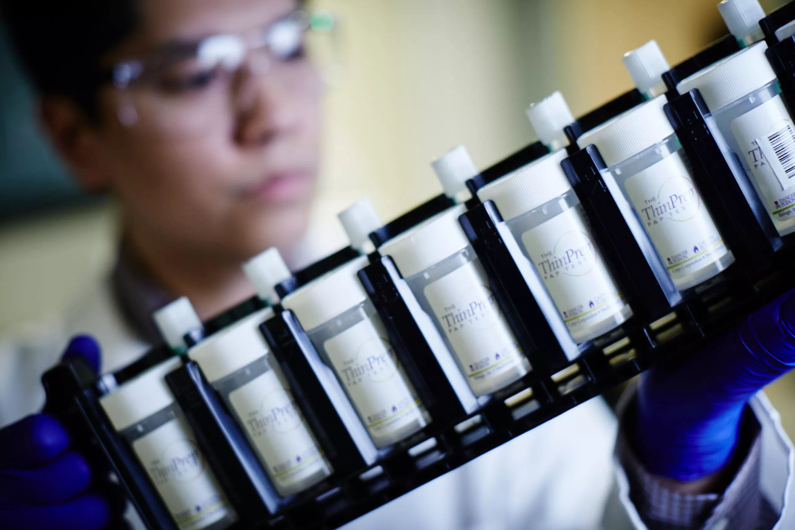 Tecnico di laboratorio con occhiali protettivi che tiene un vassoio di provette
