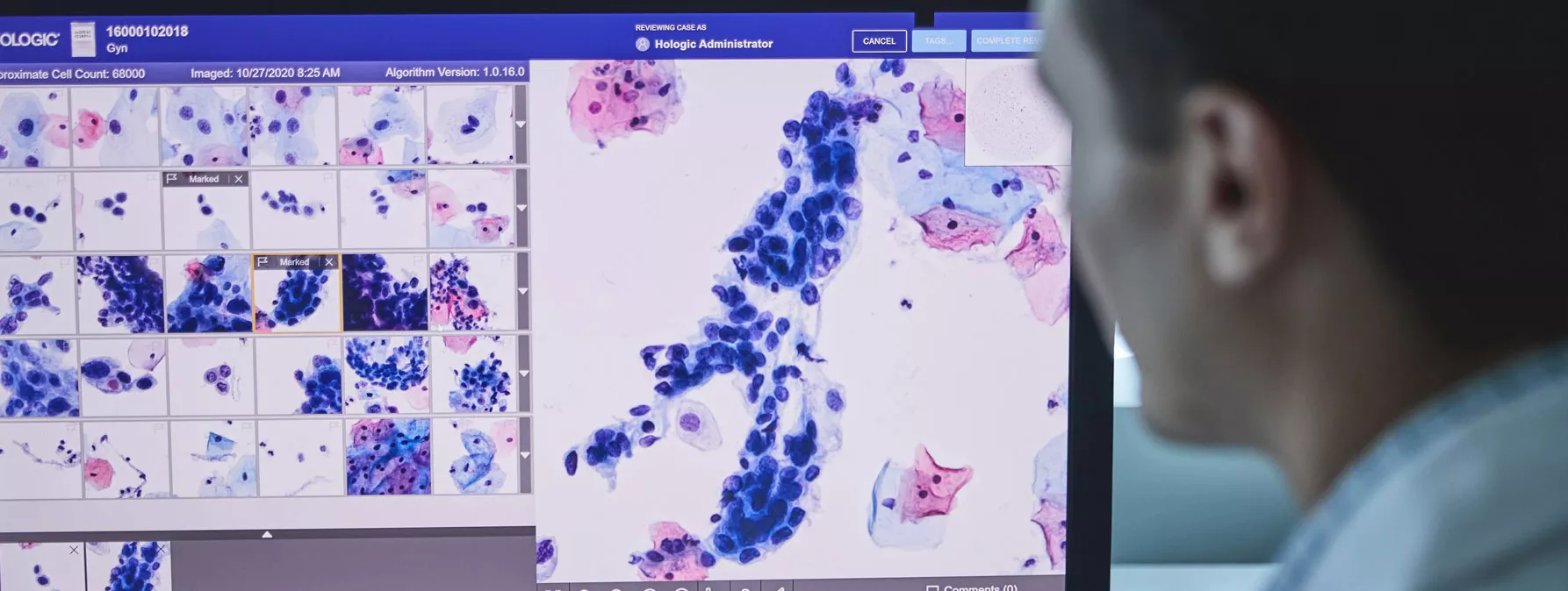 Immagine del Genius™ Digital Diagnostics System