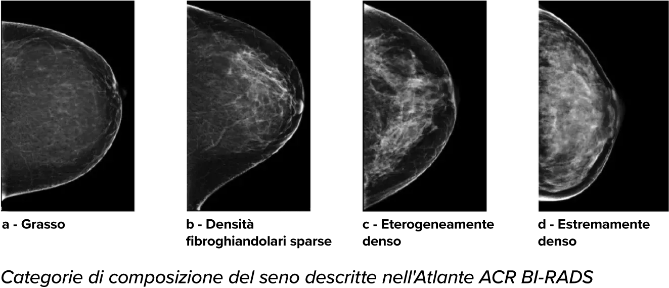 Mammografie