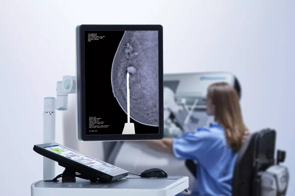 Mammografia 3D con contrasto sullo schermo di un computer