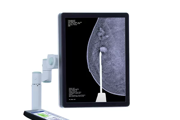 Mammografia 3D con contrasto sullo schermo di un computer