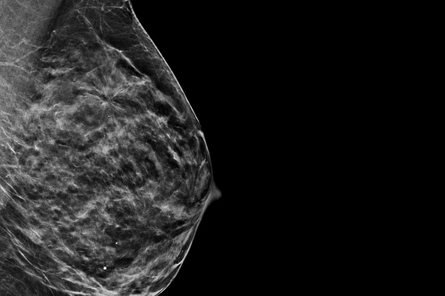 Mammografia su sfondo nero