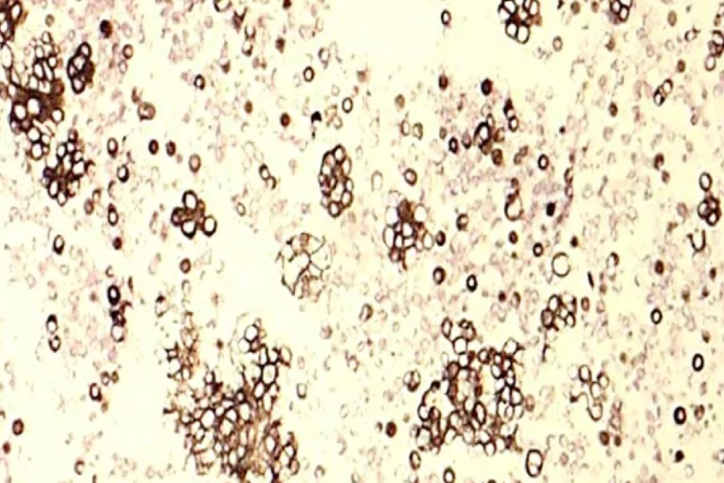 Citocheratina 7​
