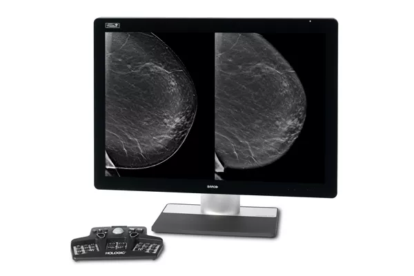 Monitor che mostra immagini mammografiche con un controller