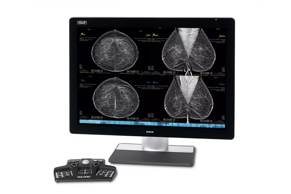 Monitor che mostra immagini mammografiche con un controller su sfondo bianco