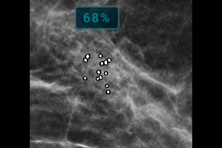 immagine radiografica
