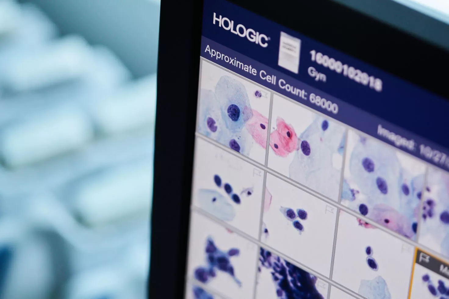 Primo piano di un monitor con immagini di scansioni e logo Hologic in un angolo