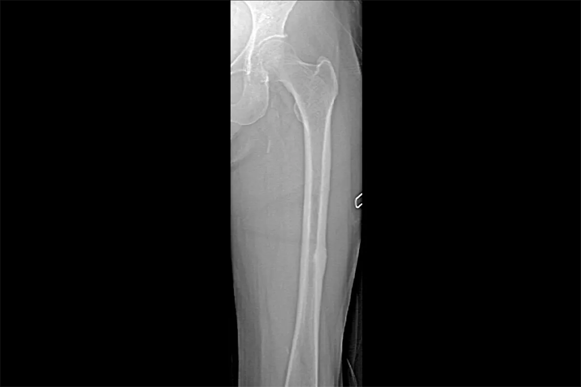 radiografia della gamba